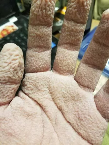 Les images les plus degoutants du monde - #29 