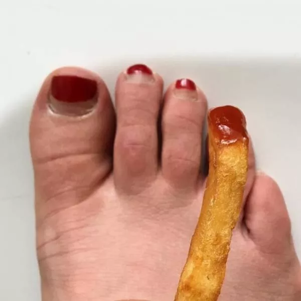 The most disgusting images of the world - #32 