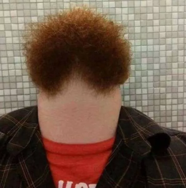 Les images les plus degoutants du monde - #35 