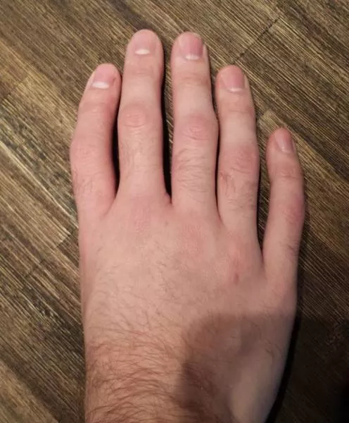 Things weirder than you think