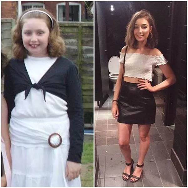 Extrem transformation - #25 