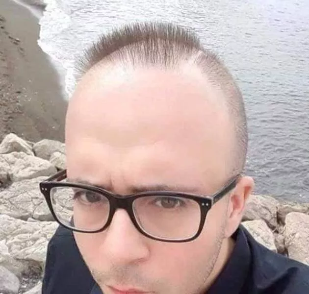 Abnormal haircuts - #13 