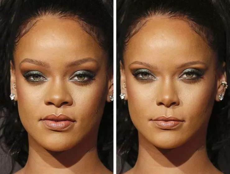 Celebs vs the golden ratio standard - #13 
