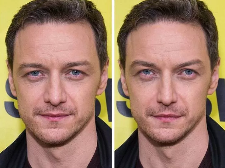 Celebs vs the golden ratio standard - #14 