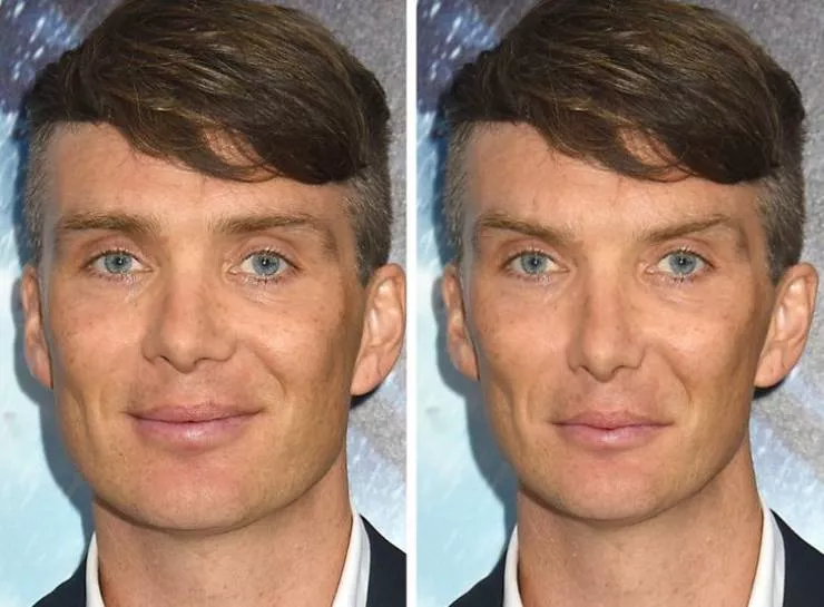 Celebs vs the golden ratio standard - #19 