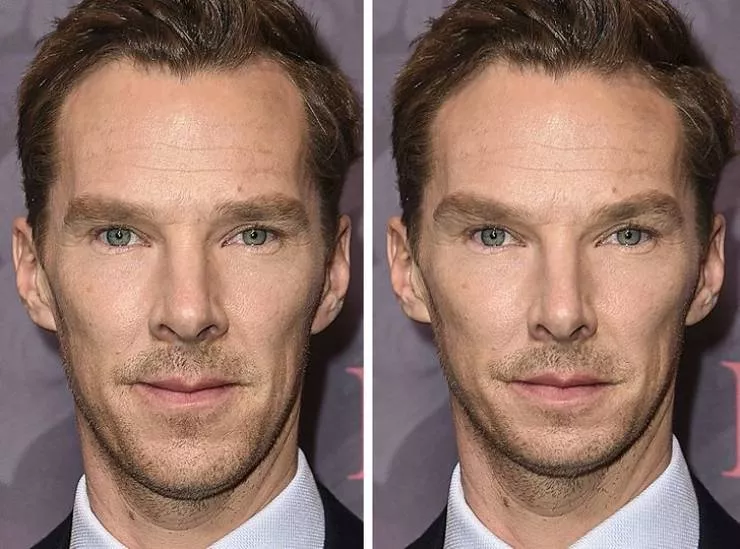 Celebs vs the golden ratio standard - #2 