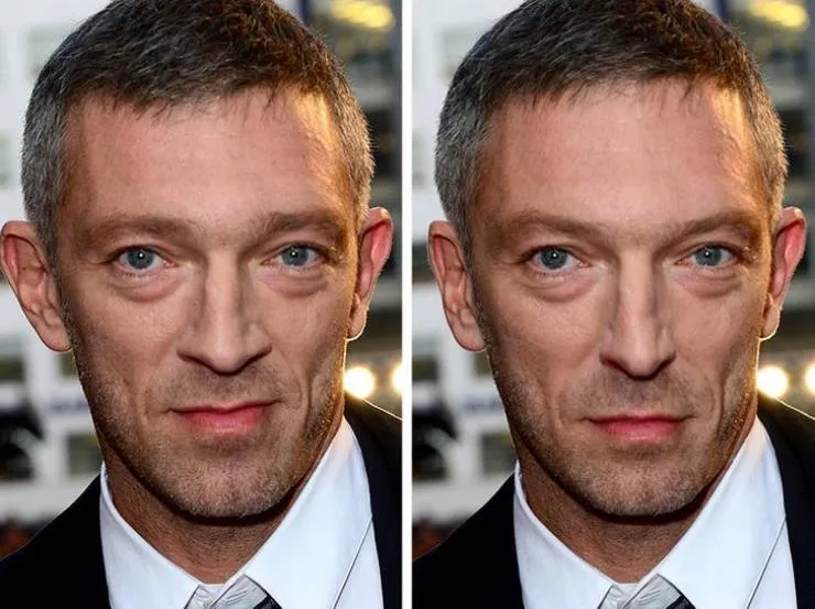 Celebs vs the golden ratio standard - #6 