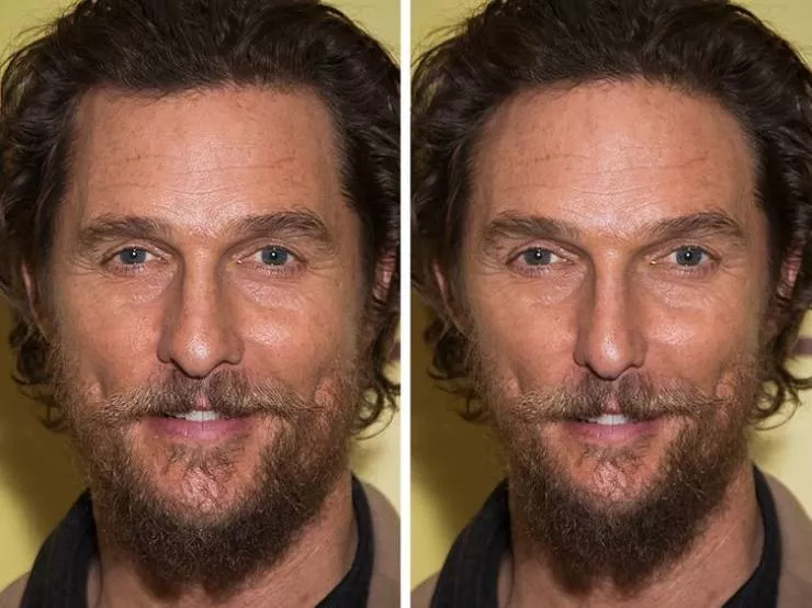 Celebs vs the golden ratio standard - #8 