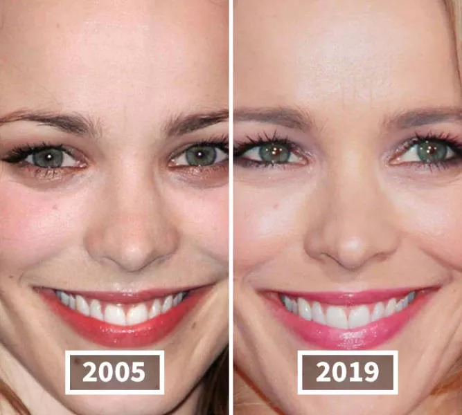 Visages des celebrite au cours du temps - #10 