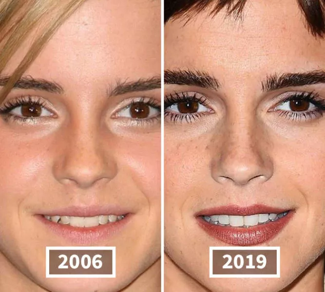 Faces of celebrities over time - #12 Faces of celebrities over time - #12