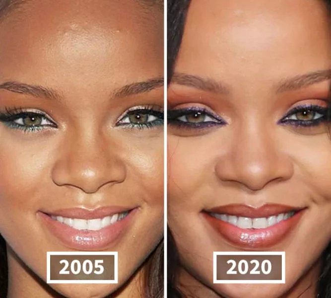 Visages des celebrite au cours du temps - #14 