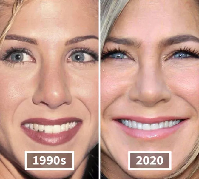 Visages des celebrite au cours du temps - #2 