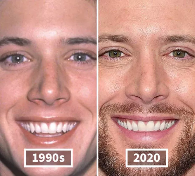 Visages des celebrite au cours du temps - #24 