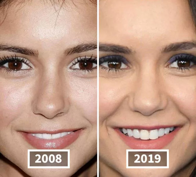 Visages des celebrite au cours du temps - #33 