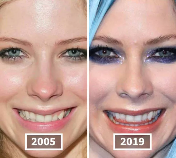 Visages des celebrite au cours du temps - #4 