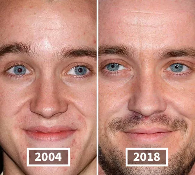 Visages des celebrite au cours du temps - #43 Visages des celebrite au cours du temps - #43