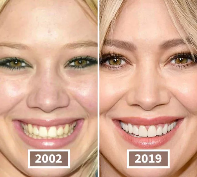 Visages des celebrite au cours du temps - #9 