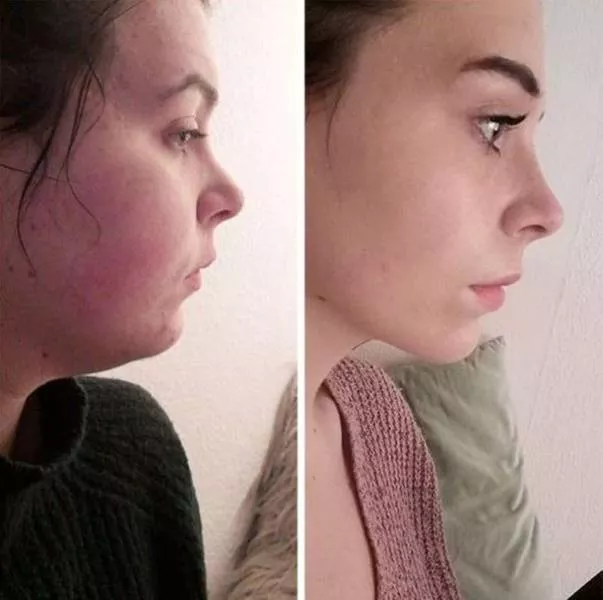 Des preuves de force de volonte incroyable - #4 Moins 56 kilos 