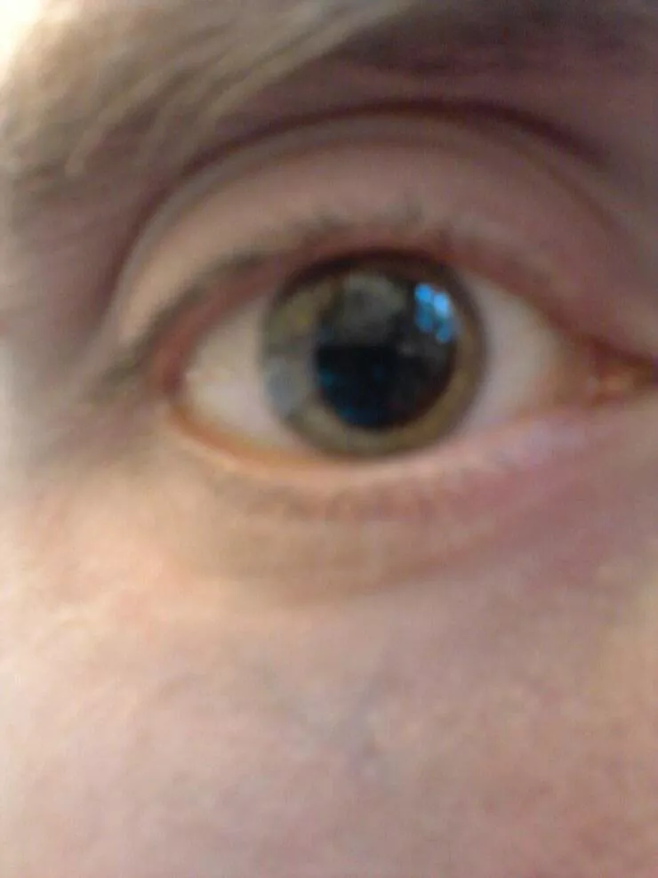 Things that will fascinate you - #34 Pupil is off center