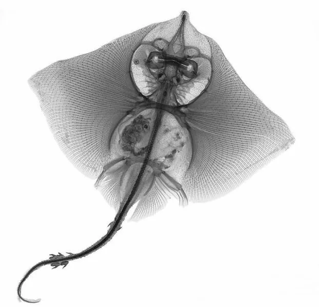 X ray vs nature