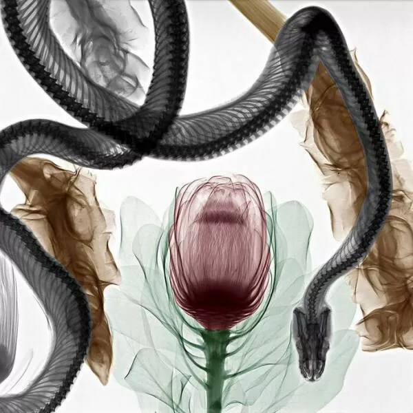 X ray vs nature - #12 