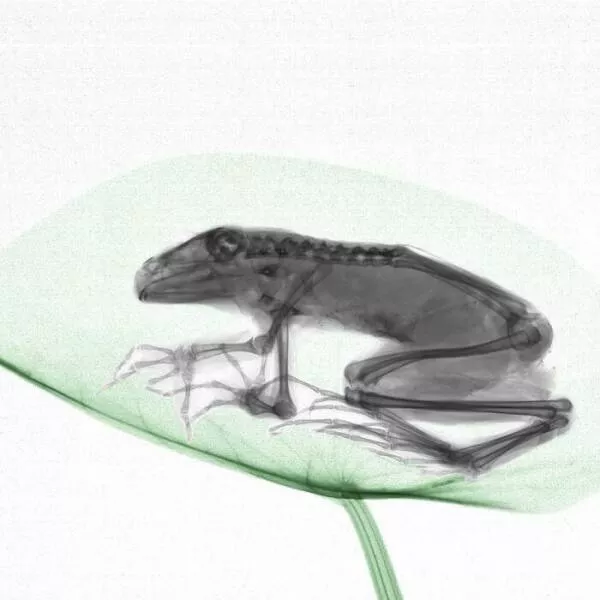 X ray vs nature - #14 
