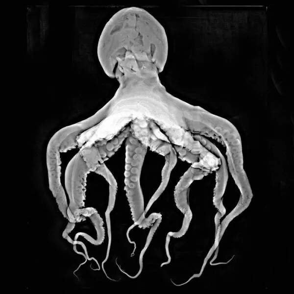 X ray vs nature - #16 