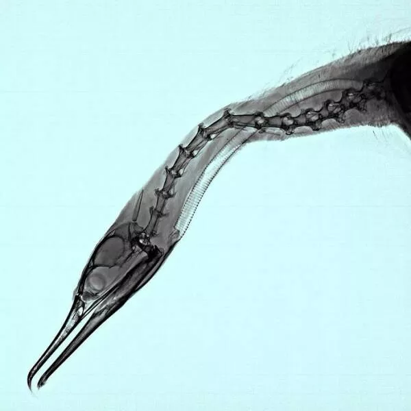 X ray vs nature - #20 