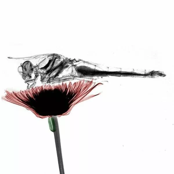 X ray vs nature - #3 