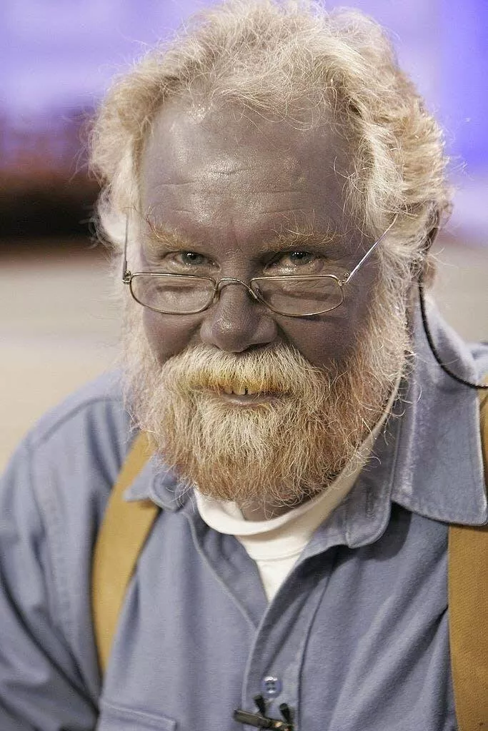 Visual marvels explore a collection of truly fascinating pictures - #33 Paul Karason, whose skin turned permanently blue after ingesting colloidal silver