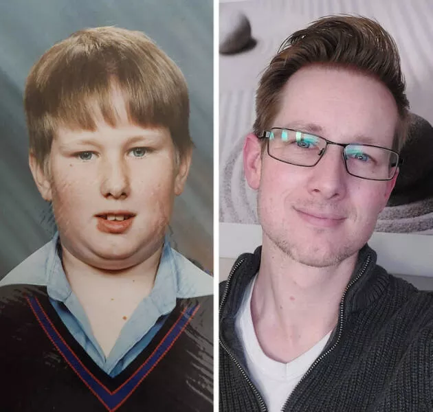 Metamorphic narratives individuals undergoing striking transformations - #10 My Journey: Not a Model, But Content with My Progress