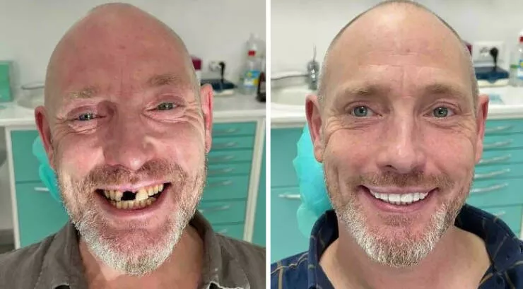 Mind bending perspectives compelling comparison photos to challenge your views - #2 A Remarkable Boost in Self-Confidence