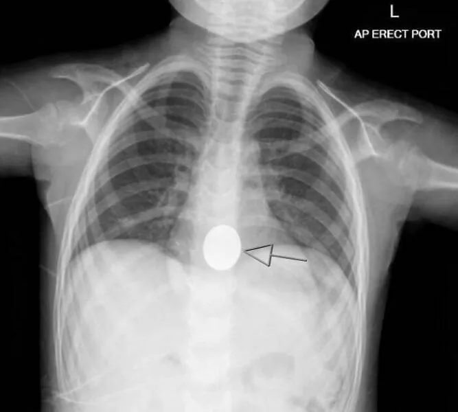 Navigating parenthood through rough patches - #3 I lost my Aldi quarter. Luckily, my 4-year-old found it and is keeping it in a safe place