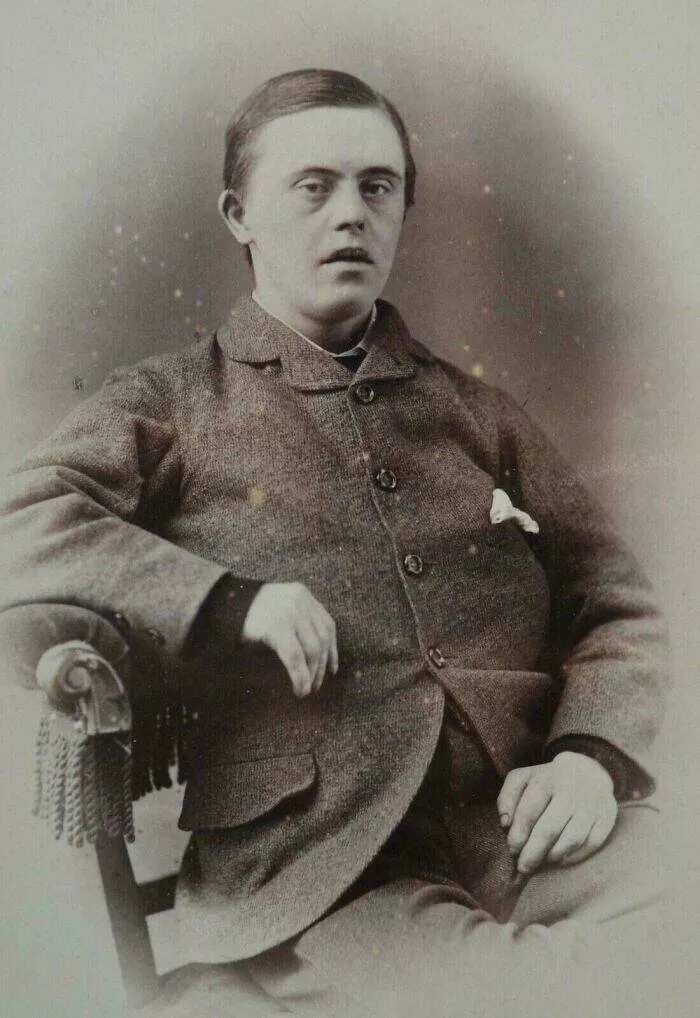 Timeless everyday moments captured in historical photographs - #20 A man with Down syndrome, 1890s