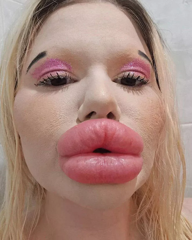 Lip filler queen andrea ivanova - #1 