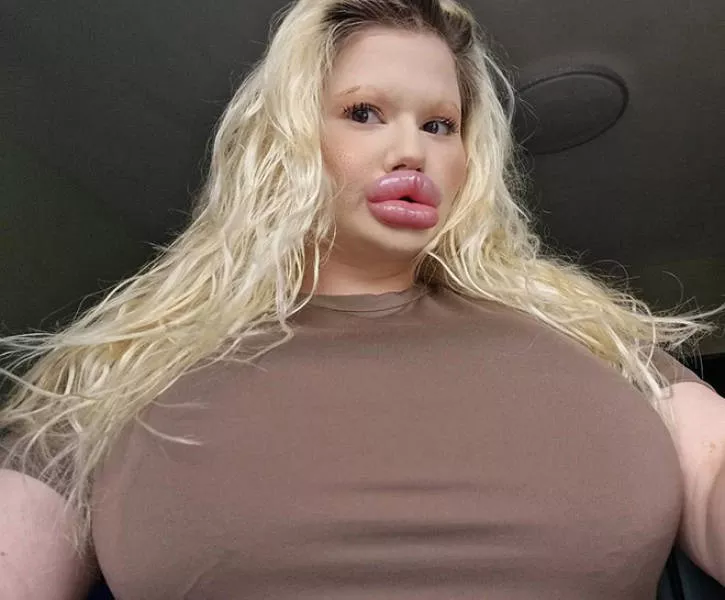 Lip filler queen andrea ivanova - #12 