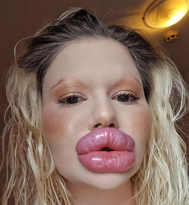 Lip filler queen andrea ivanova - #13 