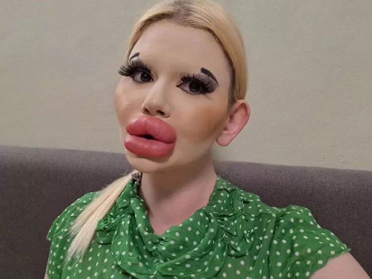 Lip filler queen andrea ivanova - #15 