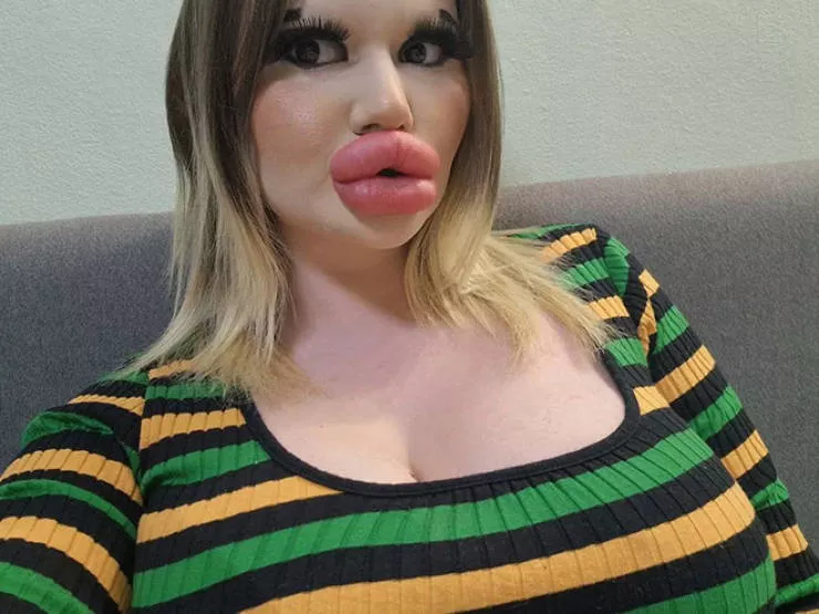 Lip filler queen andrea ivanova - #17 
