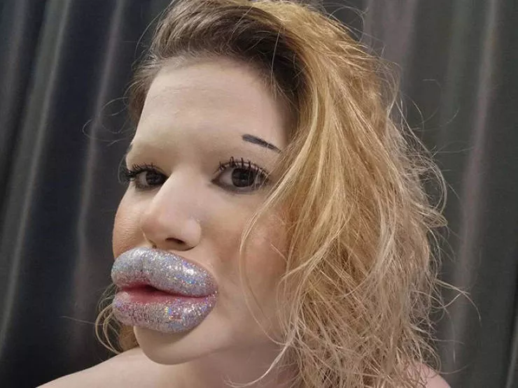 Lip filler queen andrea ivanova - #21 