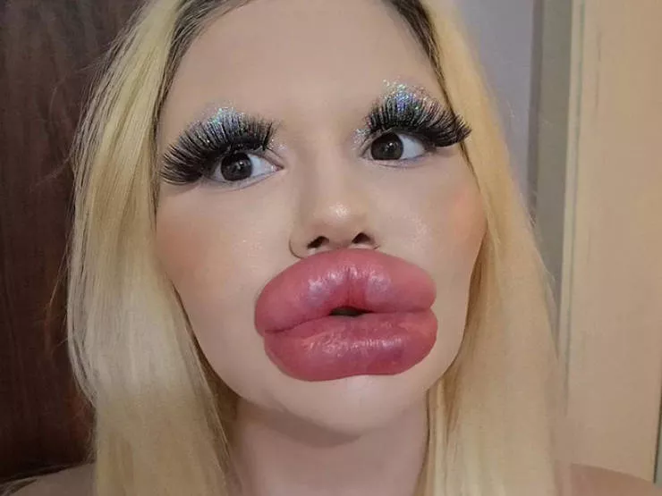 Lip filler queen andrea ivanova - #22 