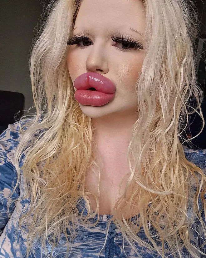 Lip filler queen andrea ivanova - #3 