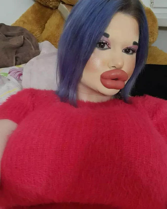 Lip filler queen andrea ivanova - #4 