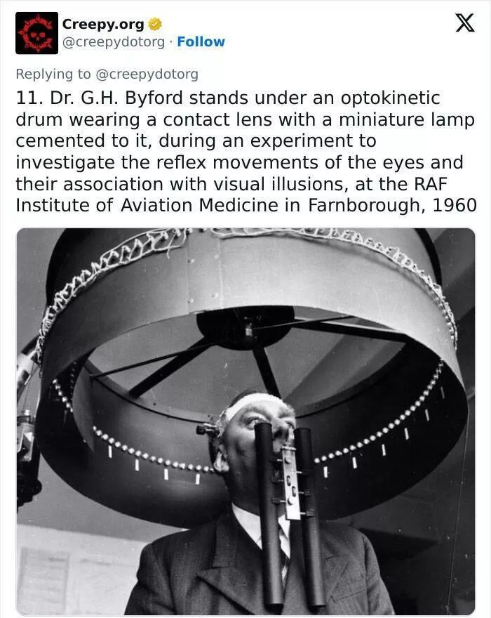 Bizarre historical medical treatments that will make you shudder - #13 