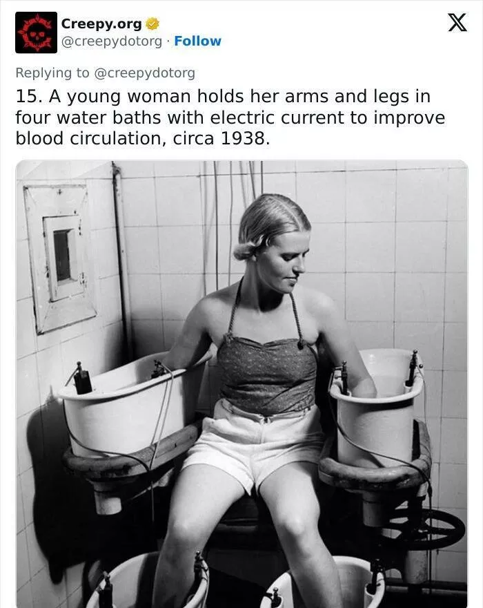 Bizarre historical medical treatments that will make you shudder - #14 