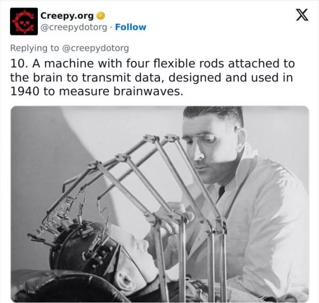 Bizarre historical medical treatments that will make you shudder - #15 