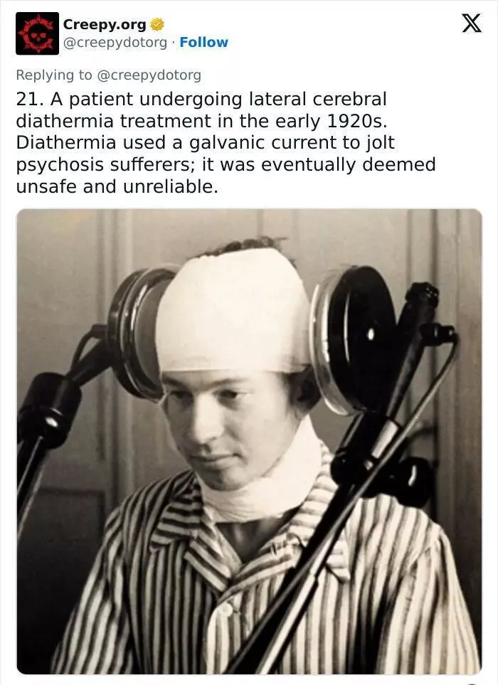 Bizarre historical medical treatments that will make you shudder - #16 