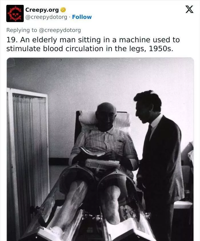 Bizarre historical medical treatments that will make you shudder - #17 