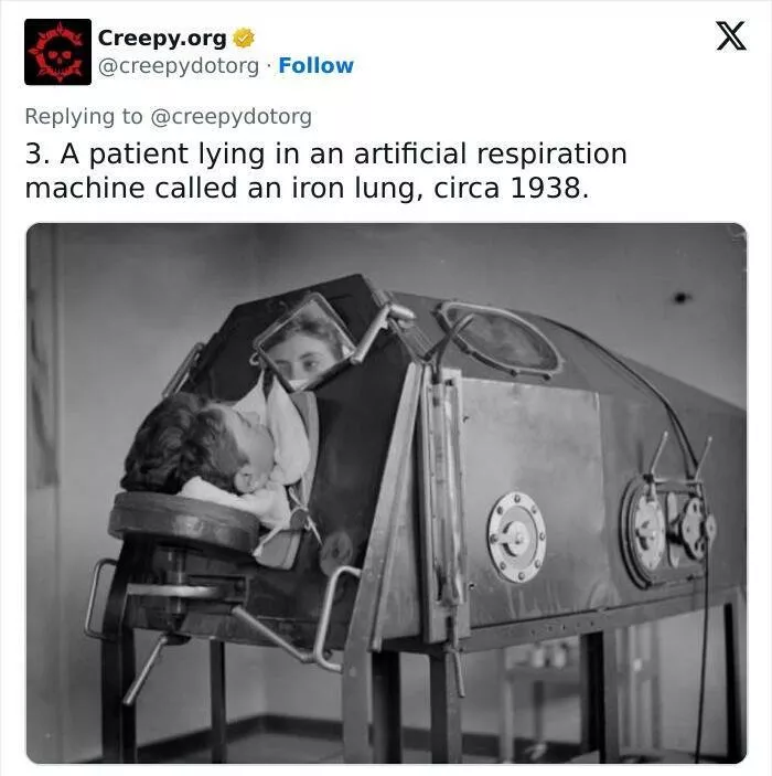 Traitements medicaux historiques bizarres qui vous donneront des frissons