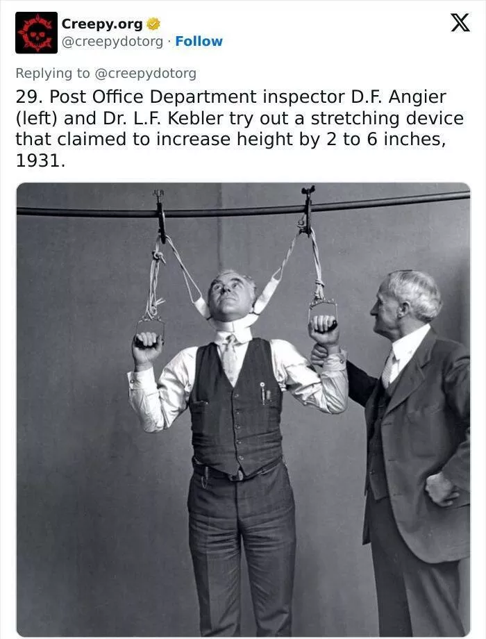Bizarre historical medical treatments that will make you shudder - #20 